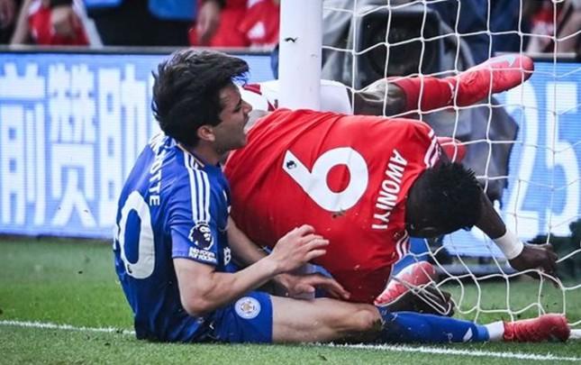 İngiltərə klubunun futbolçusu komaya düşdü - İngiltərə klubunun futbolçusu komaya düşdü -